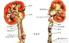 肾结核怎么治疗,肾结核治疗策略与方案详解